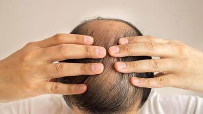 தலையில் வழுக்கையை தவிர்க்க பயன்படுத்தக்கூடாத 5 எண்ணெய்கள்! இனி அவசியம் தெரிஞ்சுக்கோங்க..