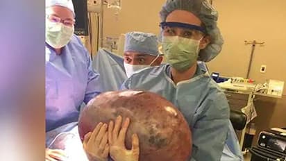 വയറുവേദനയുമായെത്തിയ യുവതിയുടെ വയറ്റിൽ നിന്ന് ഡോക്ടർമാർ കണ്ടെത്തിയത്...