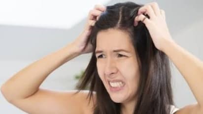 பேன் தொல்லையால் அவதியா? இந்த எளிய வீட்டு வைத்தியங்களை டிரை பண்ணுங்களேன்…