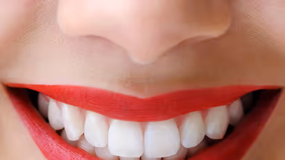 This toothpaste claims to fix your cavities and whiten your teeth, too