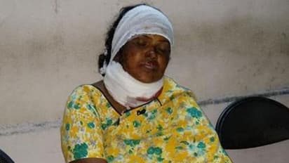 సూర్యాపేట మహిళపై పట్టపగలే కత్తులతో దాడి