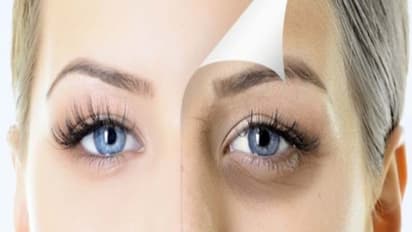 உங்களுக்குத் தெரியுமா? உடலில் நீர்ச்சத்து சீராக இல்லாவிட்டாலும் கண்களை சுற்றி சுருக்கம் ஏற்படும்...