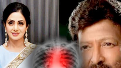 RIP Sridevi: What causes sudden cardiac arrest and what you can do to prevent it?