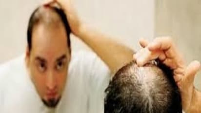 உங்களுக்குத் தெரியுமா? இந்த யுக்தியை பயன்படுத்தினால் வழுக்கைத் தலையிலும் முடி வளரும்.