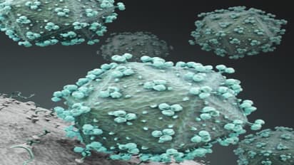 மூச்சுத்திணறல்... மூளைக்காய்ச்சல்... மரணம்... கேரளாவை அச்சுறுத்தும் நிபா வைரஸ்.... செய்யக்கூடாதது என்னென்ன..?