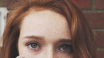 മുഖത്ത് കാണുന്ന ചെറിയ വെളുത്ത തരികള് അപകടകാരികളോ?