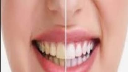 நீண்ட நாட்களாக இருக்கும் பற்கறைகளை போக்க இதோ சுலபமான வழி...