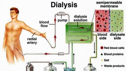 டயாலிசிஸ் செய்பவர்கள் இவற்றில் மிகவும் கவனாமக இருக்கவும்.