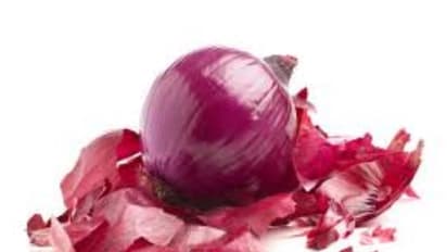 இனி வெங்காய தோலை தூக்கி எறிய வேண்டாம்! இப்படி பயன்படுத்தி உடல் ஆரோக்கியம் பெறுங்கள்...