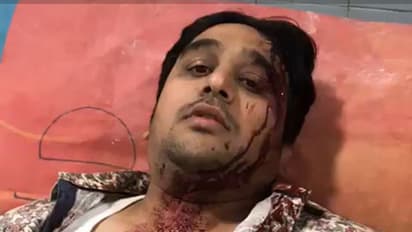 రెచ్చిపోయిన నాగోల్ టీఆర్ఎస్ కార్పోరేటర్ అనుచరులు (వీడియో)