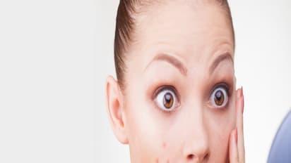 మెరిసే చర్మం కోసం 4 ఫేస్ ప్యాక్స్.. ఇవి పాటిస్తే అందమే అందం!