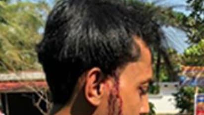 വാഹന പരിശോധനക്കിടെ പോലീസ് മര്ദ്ദനം; യുവാവിന് തലയ്ക്ക് മുറിവേറ്റു