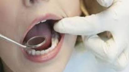 உங்க பல் ஓட்டையா....? சிரிக்க அசிங்கமா ..? "டென்டல் இம்பிளான்ட்ஸ்" செஞ்சுக்கோங்க..!