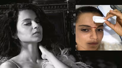 In Pics: Here is why Kangana Ranaut is hospitalised
