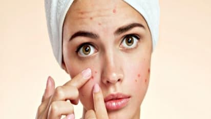 தோலில் ஏற்படும் அனைத்து பிரச்சனைகளை போக்க இந்த மூன்று மூலிகையே போதும்... எளிதில் கிடைக்கும்ங்க....