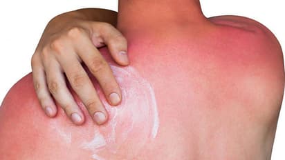 Health Tips: സംസ്ഥാനത്ത് ചൂട് കൂടുന്നു; സൂര്യാഘാത സാധ്യത തടയാന്‍ ചെയ്യേണ്ട കാര്യങ്ങള്‍