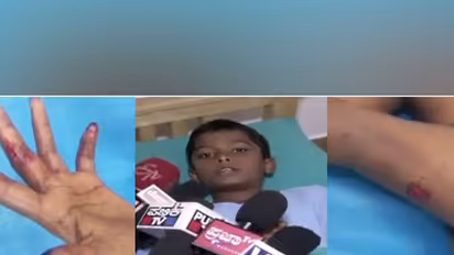 11-year-old Karnataka boy fights off Python attack