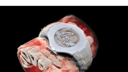 ബ്ലാക്ക് ആന്ഡ് വൈറ്റില് അല്ല; ഇനി എക്സ്റെ കളറില് കാണാം