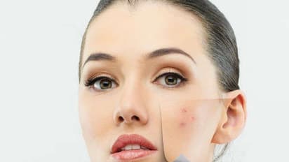 பளிச்சென்ற முகம் பெற வேண்டுமா? இதோ பக்கவிளைவு இல்லாத இயற்கை வைத்திய முறை...