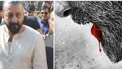 ചോരയൊലിപ്പിച്ച് സഞ്ജയ് ദത്ത്