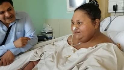 500 கிலோவாக வந்து.. 170 கிலோவாக விடைபெறுகிறார் எகிப்து “குண்டு பெண்”