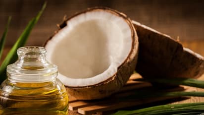 ಹಲ್ಲಿನ ಬಿಳುಪಿಗೂ ಸಹಕಾರಿ: ನಿಮಗರಿಯದ ಕೊಬ್ಬರಿ ಎಣ್ಣೆಯ ಗುಣಗಳಿವು