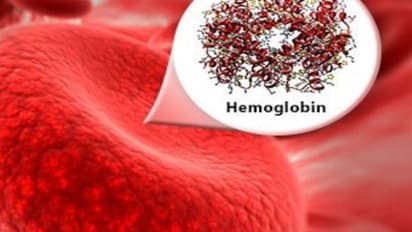 உடலில் ஹூமோகுளோபின் அதிகரிக்க இவற்றை சாப்பிட்டாலே போதும்...