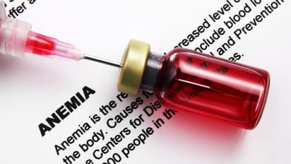 ಕಣ್ಣುಗಳಲ್ಲಿ ಈ ಬದಲಾವಣೆ ಕಂಡ್ರೆ ಕಬ್ಬಿಣಾಂಶದ ಕೊರತೆ ಇದೆ ಎಂದರ್ಥ 