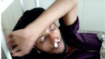 വിദ്യാർത്ഥിയെ ബസ് ജീവനക്കാരൻ മർദ്ദിച്ചു, മൂക്കിന് ഗുരുതരമായി പരുക്ക്