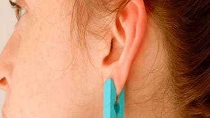 உங்களுக்குத் தெரியுமா? அதிபயங்கரமான மூட்டு வலியை போக்க காதில் துணி கிளிப் மாட்டணும்...