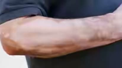 சருமத்தில் அசிங்கமாக தெரியும் தேமலை மறையச் செய்ய சித்த வைத்தியத்தில் தீர்வு இருக்கு..