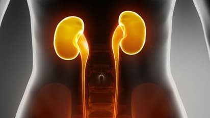 ஆரோக்கியமான சிறுநீரகங்களை பெறவும், அவற்றை பாதுகாக்கவும் இதையெல்லாம் செய்யலாம்...