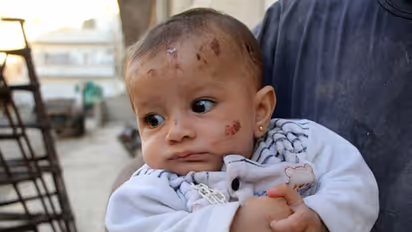 ബോംബാക്രമണത്തില് തകര്ന്ന കെട്ടിടത്തിനിടയില്നിന്നും ചോരക്കുഞ്ഞിനെ രക്ഷപ്പെടുത്തി