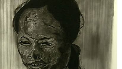 వరంగల్ లో అమ్మాయిపై యాసిడ్ దాడి