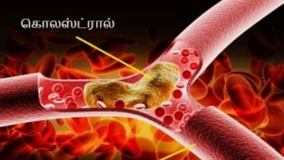 கொலஸ்ட்ரால் பிரச்சனையை இரண்டே வாரத்தில் குறைக்க உதவும் வீட்டு மருந்து...