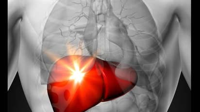 உங்கள் கல்லீரல் பாதிக்கப்பட்டுள்ளதா? என்பதை இந்த அறிகுறிகளை வைத்து கண்டுபிடிக்கலாம்? தீர்வும் இருக்குங்க...