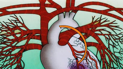 രാജ്യത്ത് ഹൃദയാഘാതം കൂടുന്നു; നിങ്ങളുടെ ഹൃദയത്തെ കുഴപ്പത്തിലാക്കുന്ന 5 ഭക്ഷണങ്ങള്