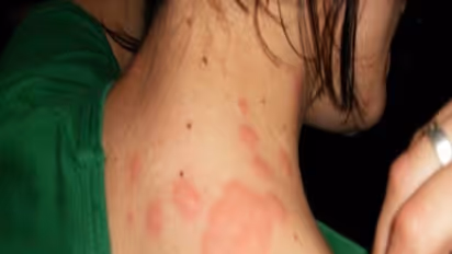 உங்களுக்குத் தெரியுமா? வெற்றிலையுடன், மிளகு சேர்த்துக் உண்ண வண்டு விஷம் இறங்கும்...