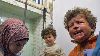 Watch: In Syria, even photographers are now rescuing injured children