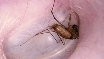 உங்களுக்குத் தெரியுமா? காதினுள் புகுந்த பூச்சியை எடுக்க உப்புக் கரைசல் உதவும்...