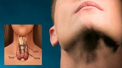 உஷார்: இந்த அறிகுறிகள் இருந்தால் உங்களுக்கு தைராய்டு இருக்குனு அர்த்தம்…