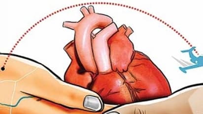 അവയവ മാറ്റത്തിന് ഏകീകൃത ചട്ടങ്ങൾ രൂപീകരിക്കണമെന്ന് കേന്ദ്രസർക്കാരിനോട് സുപ്രീംകോടതി 