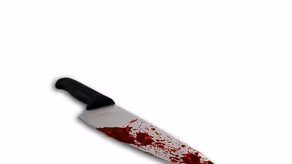 യുവതിയെ റോഡിലേക്ക് തള്ളിയിട്ട് കത്തി കാണിച്ച് കവര്ച്ച നടത്താന് ശ്രമിച്ച കള്ളന് സംഭവിച്ചത്