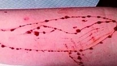 ಬೆಂಗಳೂರಿನ ವಿದ್ಯಾರ್ಥಿ ಬ್ಲೂವೇಲ್ ಗೆ ಬಲಿ..?