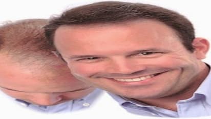 முடி உதிர்வதை நினைத்து தூக்கத்தை தொலைத்தவரா நீங்கள்? இதோ உங்களுக்கான தீர்வு…