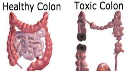 நச்சுகள் நிறைந்த குடலை சுத்தம் செய்ய இதோ எளிய வழிகள்…