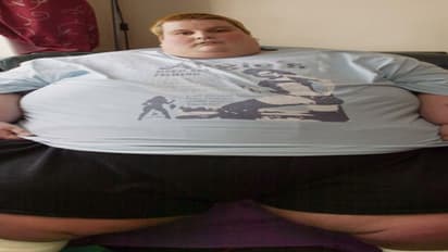 உங்களுக்குத் தெரியுமா? அதிக உடல் எடை உள்ளவர்கள்தான் நோய்த் தாக்குதலுக்கு அதிகம் ஆளாகின்றனர்