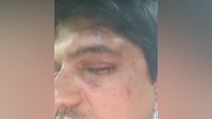 Photo provided by the man who alleged assault on him in Bengaluru (Photo/ANI)