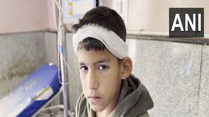 Young boy injured in Baramulla (Photo/ANI)