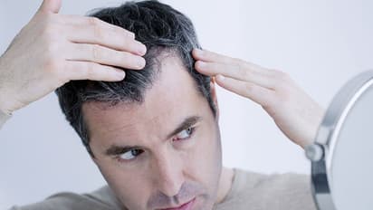 White Hair Reasons: நரைமுடி பிரச்சனை இருக்கா..? முடியை எளிதாக கருப்பாக்க, இதை மட்டும் பாலோ பண்ணுங்கோ...